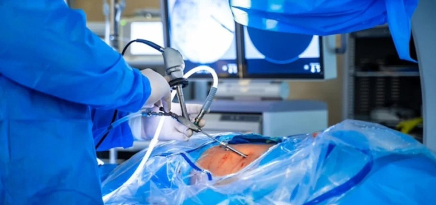 Cancer Surgery