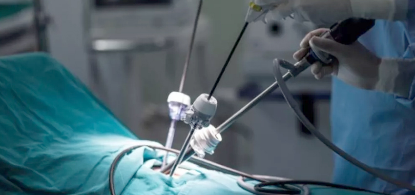 Minimal Access Surgery